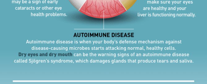 eye health info Maple Grove