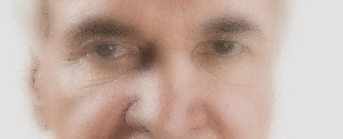 cataract effect Maple Grove