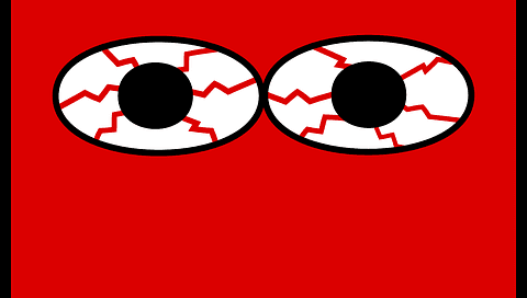 Red eyes Maple Grove Eye Doctors