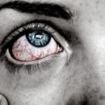 red eye-Maple Grove Eye Doctors
