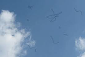 Floaters Maple Grove Eye Doctors