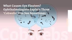 Floaters in eyes Maple Grove Eye Doctors at Pearle Vision