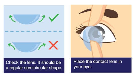 Contact Lens Insertion Maple Grove Eye Doctors