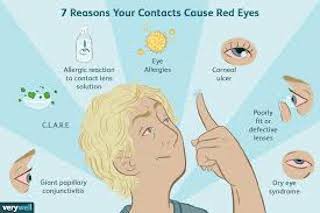 Reasons for Red Eyes Maple Grove Eye Doctors at Pearle Vision