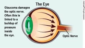 Optic Nerve Maple Grove Eye Doctors at Pearle Vision